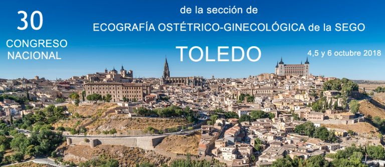 Tratamientos de miomas